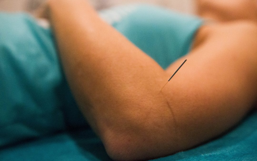 Acupuncture For A Better Night’s Sleep