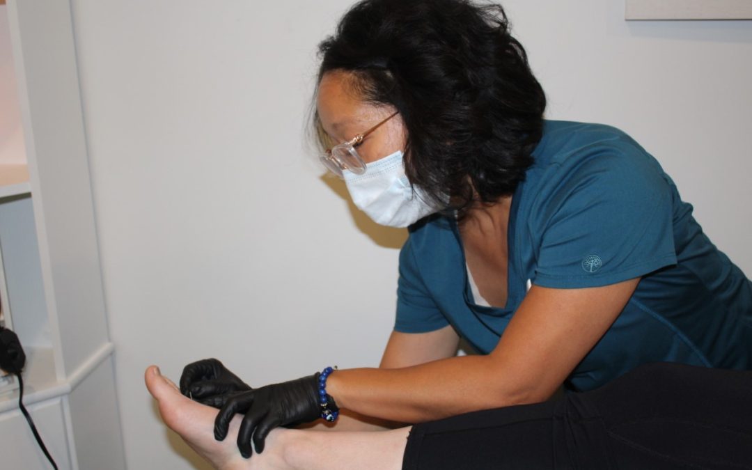 Acupuncture for leg and foot pain