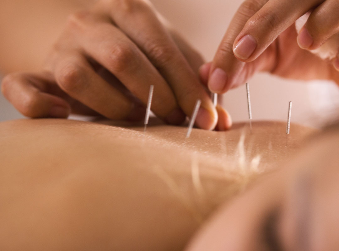 Acupuncture & Chinese Medicine