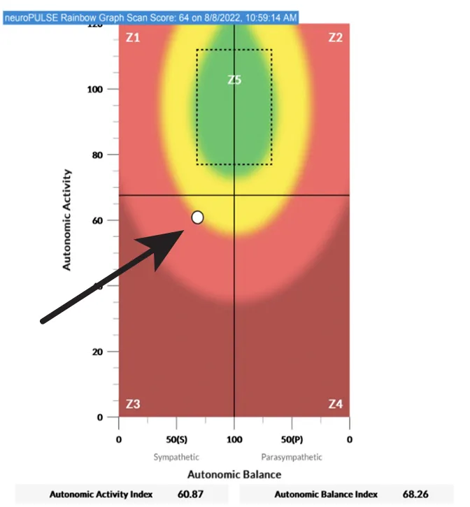 INSiGHT Scan Heart Rate Variability