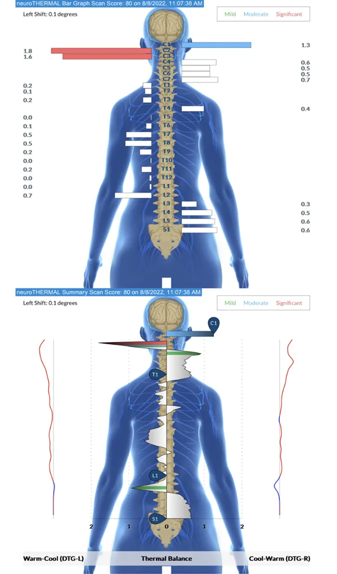 Thriving: Having INSiGHT Into Your Central Nervous System is