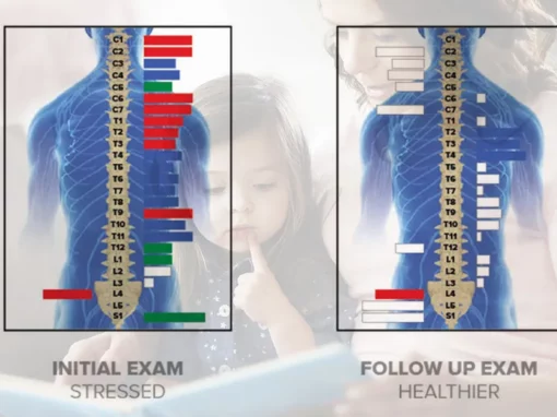 Having INSiGHT Into Your Central Nervous System is Critical for an Informed Wellness Plan